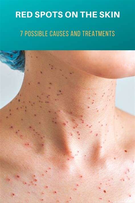 Red Spots On The Skin 7 Possible Causes And Treatments Skin What Is