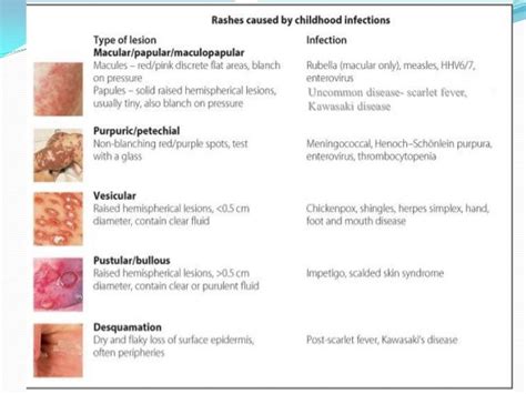 Approach To Fever With Rashes