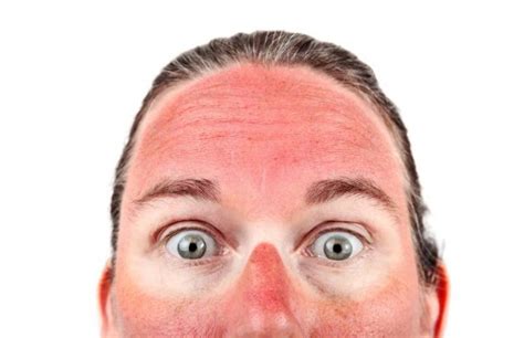 Treating A Burning Skin On Face With Rash Itchy Or Red Skincarederm