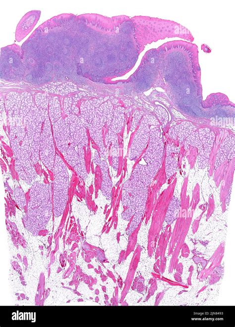 Human Lingual Tonsil Light Micrograph Stock Photo Alamy