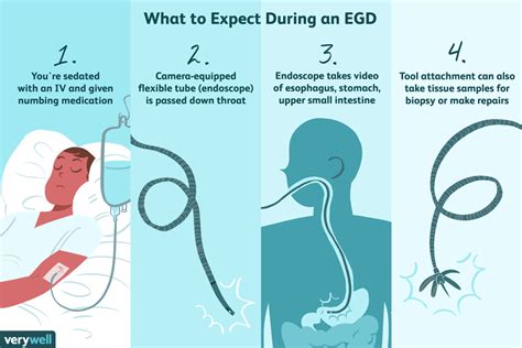 EGD Uses Side Effects Procedure Results