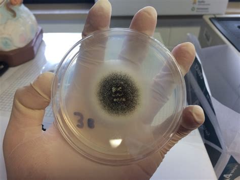 Potato Dextrose Agar Scheda Del Terreno Di Coltura Per Microbiologia