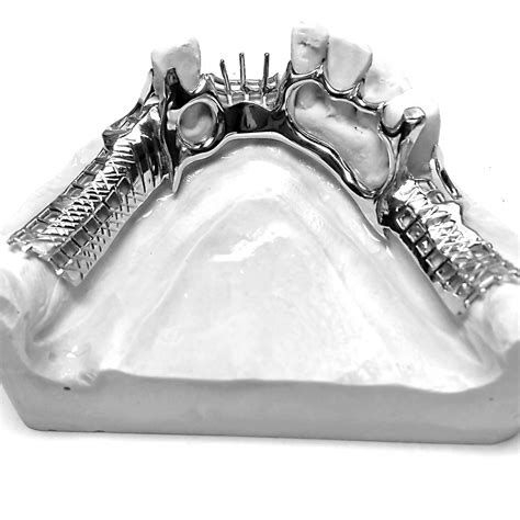 Châssis métallique (stellite) dentaire | Laboratoire Simon N