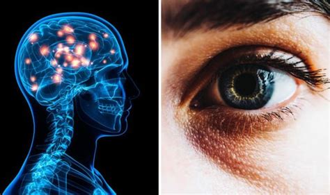 Secret Of Consciousness Scientists Reveal Where The Mind Lives Inside