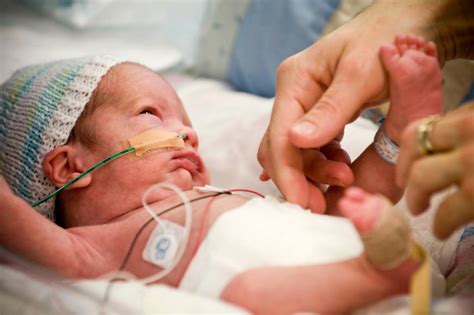 Premature Babies Facts And Trivia