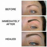 Images of Permanent Makeup Eyebrows Healing