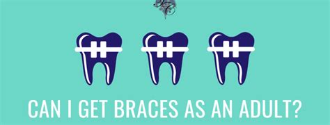 Can I Get Braces As An Adult Dr Tim Chauvin Lafayette Louisiana