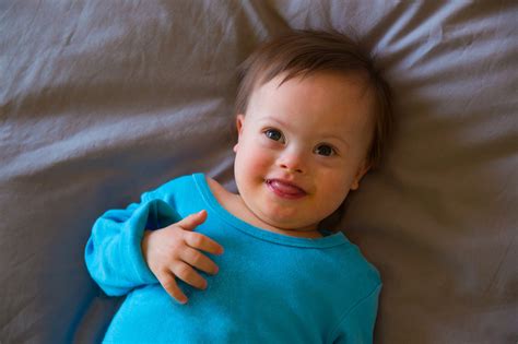 The Supreme Court Should Protect Unborn Children With Down Syndrome