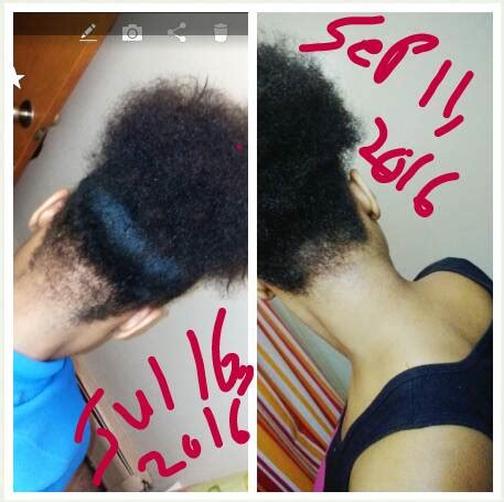 Promotes thick, long hair growth Wild Growth Hair Oil - Do the results match the hype?