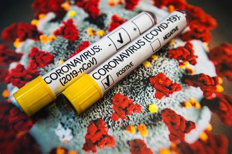 Szczepienia przeciw koronawirusowi są dobrowolne. Koronawius w Polsce. Ile kosztują szczepionki przeciw ...