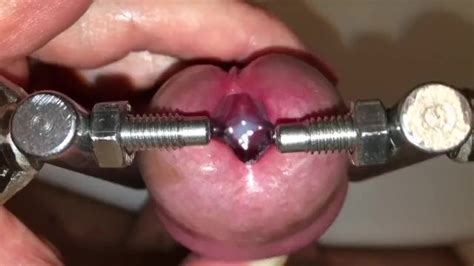 Urethral Stretching With Super Device My Urethra Is Filled With Sperm Xxx Mobile Porno