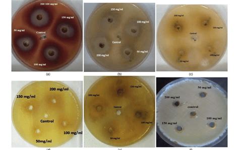 Antimicrobial Activity Of Plant Extracts By Well Diffusion Method