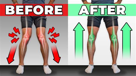 How To Unfck Your Knees In 10 Minutesday Corrective Routine Youtube
