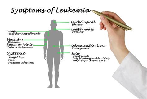 Types And Symptoms Associated With Leukemia Vitalhealth