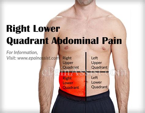 What Is In The Lower Right Abdominal Quadrant Ovulation