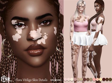 Flora Vitiligo Skin Details The Sims 4 Catalog