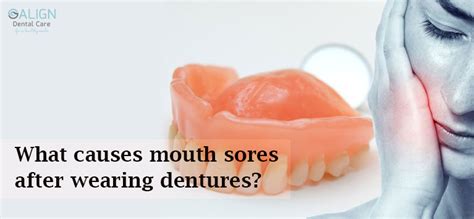 What Causes Mouth Sores After Wearing Dentures