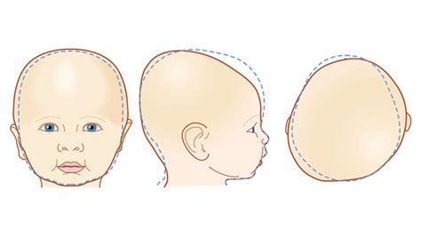 Infant Head Deformity Explained Time Out Abu Dhabi