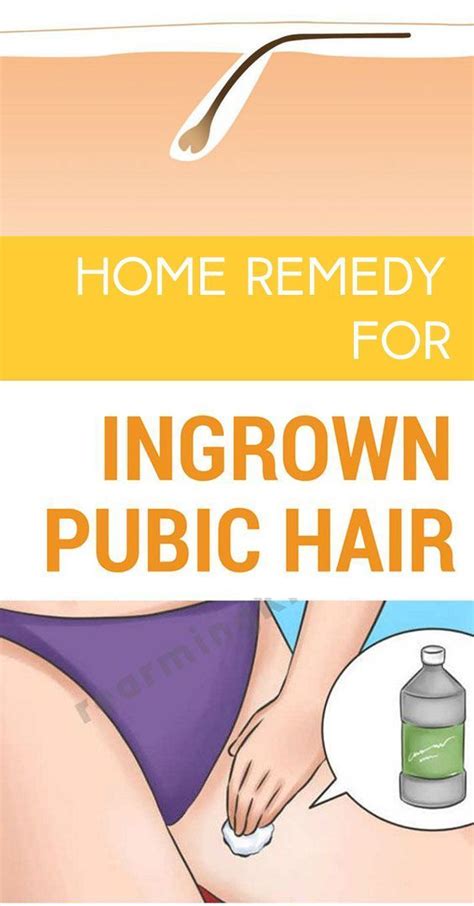 You are so not alone. Pin on Ingrown Hair Causes