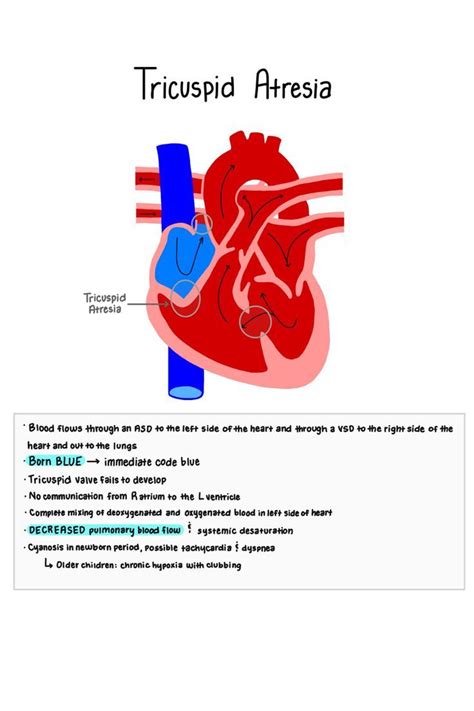 Understanding Tricuspid Atresia In Pediatric Congenital Heart Defects