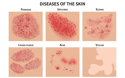 Causes Of Itchy Skin