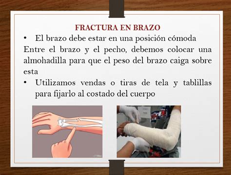 Primeros Auxilios De Fracturas On Emaze