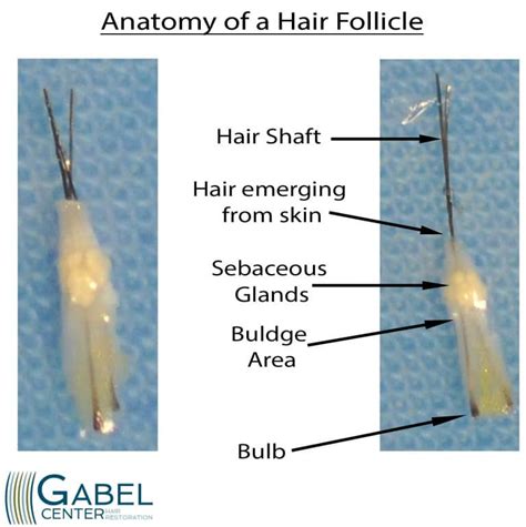 The Hair Follicle Anatomy Gabel Center