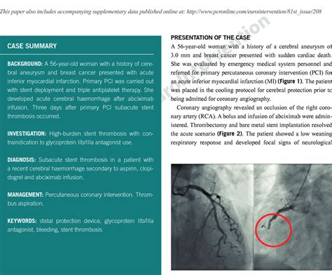 Inferior Acute Myocardial Infarction Download Scientific Diagram