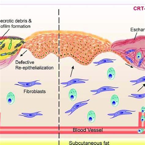 Calreticulin Crt Ameliorates Most Defects In Diabetic Wound Healing