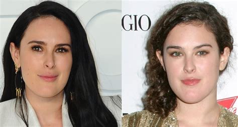 Rumer Willis Chin Before And After Possible Plastic Surgery