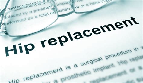 What Happens When A Hip Replacement Fails Nash And Franciskato Law Firm