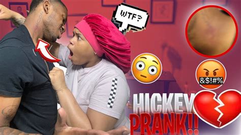 Hickey Prank On Girlfriend 😳 Gone Wrong Youtube