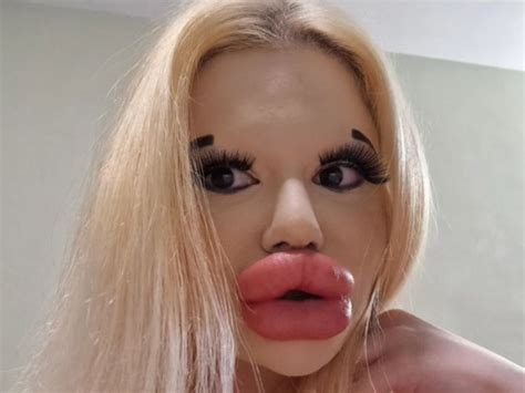 Meet The Woman With The World S Largest Lips