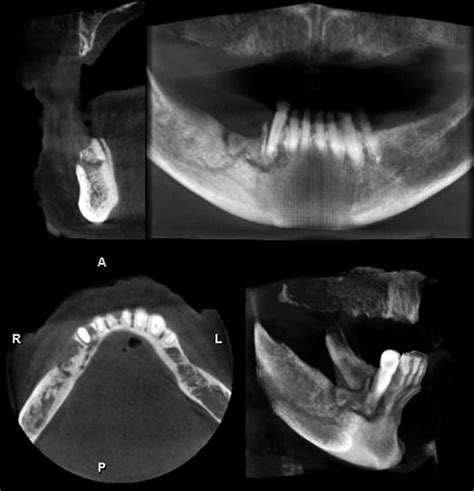 Preoperative Cbct Scan Download Scientific Diagram