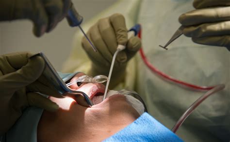 Maxillofacial Surgery Algodones Dentists Guide