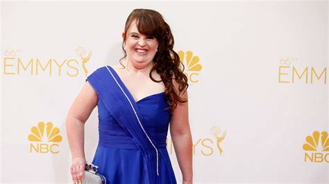 Meet The First Down Syndrome Model To Walk New York Fashion Week