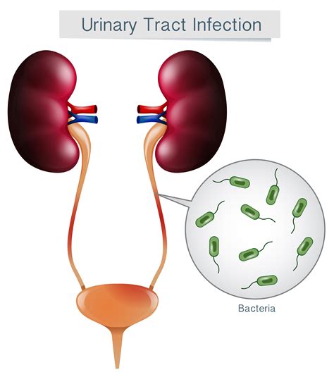 How To A Prevent Urinary Tract Infection In The Elderly Project Heartbeat