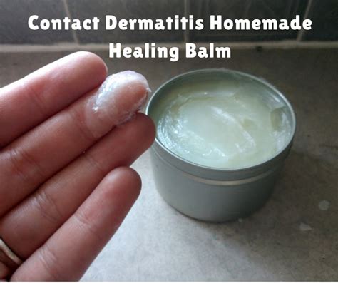 How I Got Rid Of Itchy Contact Dermatitis The Natural Way Remedygrove