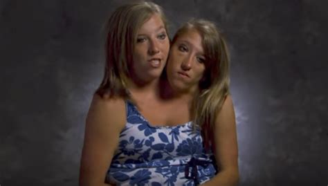 Abby and brittany hensel are conjoined twins. An Update on Abby and Brittany Hensel — The World's Most Famous Conjoined Twins - Page 14 - New ...