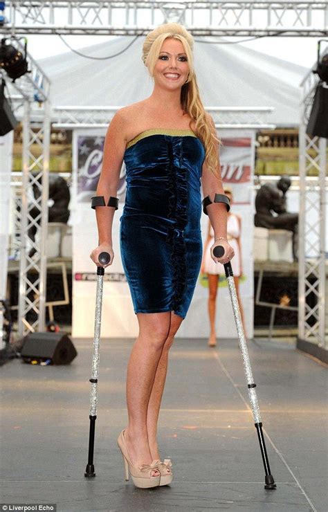 Hollyoaks Kelly Marie Stewart Believes She Was Zika Virus Victim Disabled Women Amputee Lady