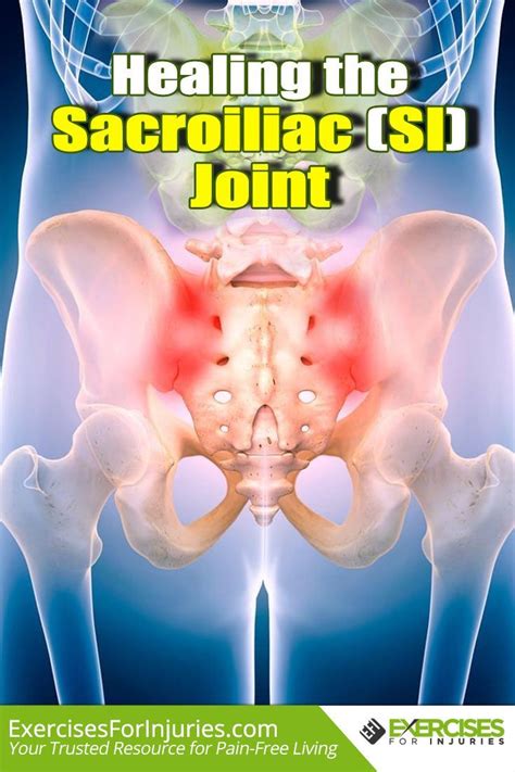 Sacroiliac Joint Pain Causessymptoms Pain Relievingphysiotherapy