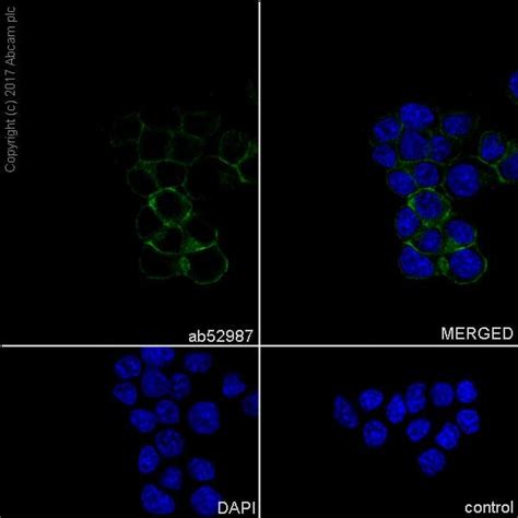 Recombinant Anti P75 Ngf Receptor Antibody Ep1039y Ab52987 Abcam