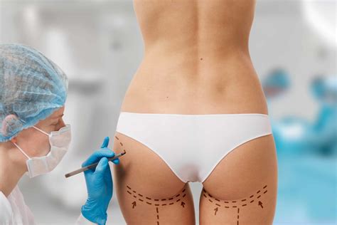 Butt Lift Surgery Types Results Recovery Risks
