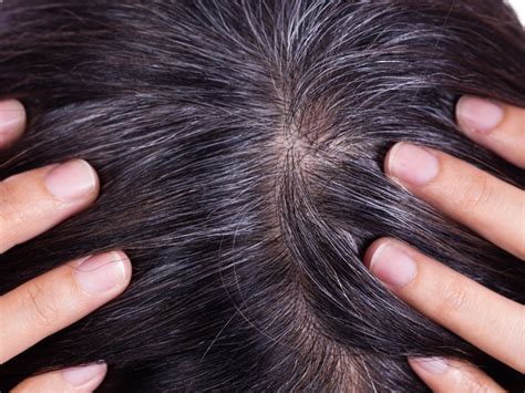 Hair turns grey when the hair follicles produce less melanin. 10 Best Home Remedies for Gray Hair at Young Age - NewsMeter