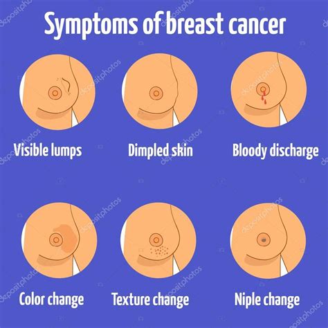 Can vary depending on the type of cancer but may include unexpected lumps or bumps, lesions, bleeding, unexplained weight loss. Breast cancer symptoms. Vector illustration. Different ...