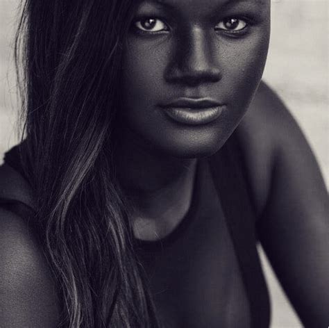 Model Opens Up About Being Bullied For Extremely Dark Skin