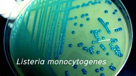 Listeria Monocytogenes Youtube