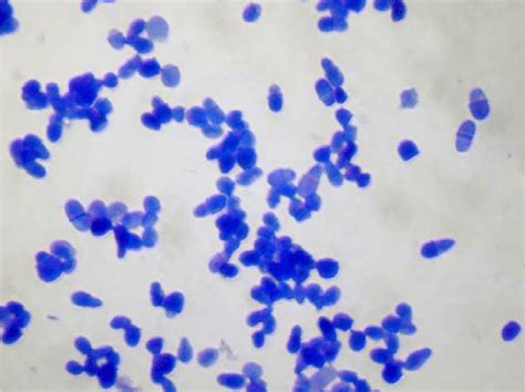 Microscopic Image Of A Malassezia Spp Culture Methylene Blue Staining