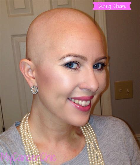 What To Expect During Chemo 12 Tips From A Survivor Chemo Hair