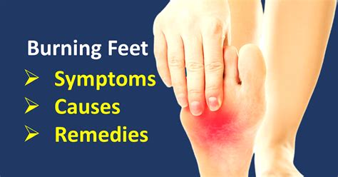 Burning Sensation In Feet Causes And Home Remedies